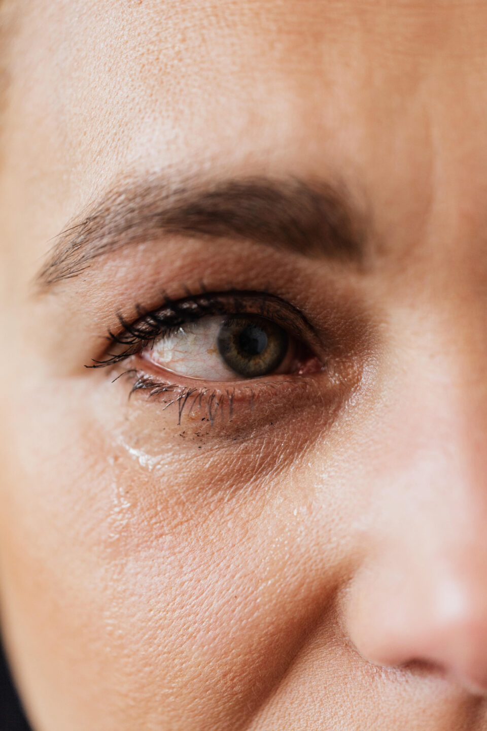 causes, symptômes et remèdes des yeux rouges