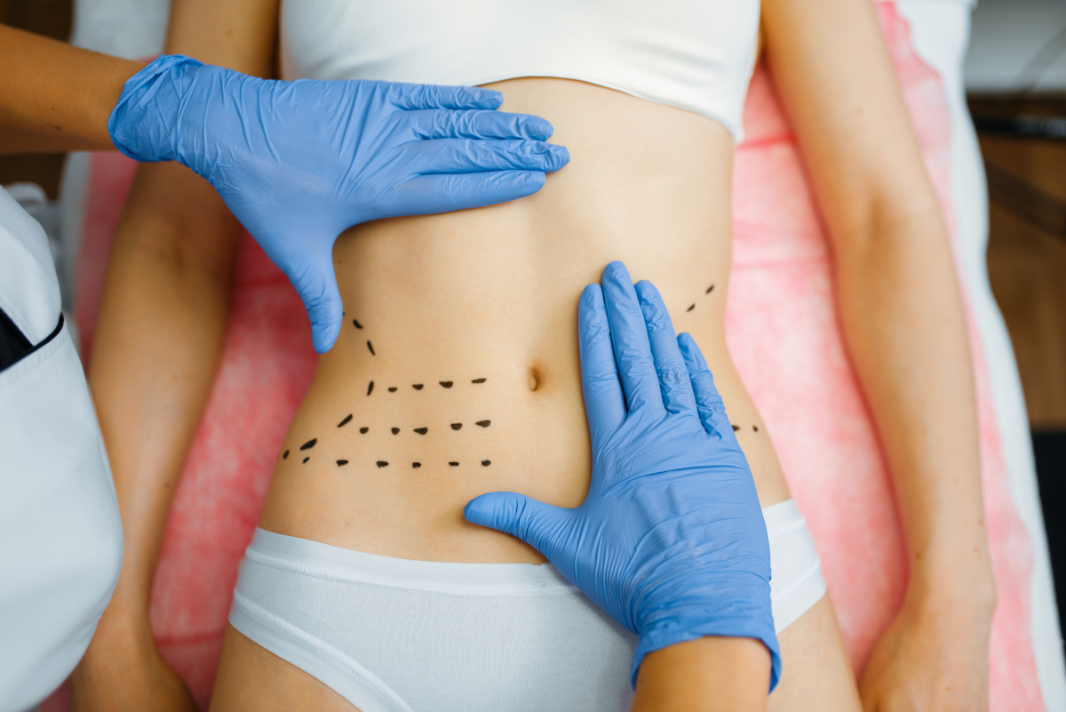 liposuccion Turquie