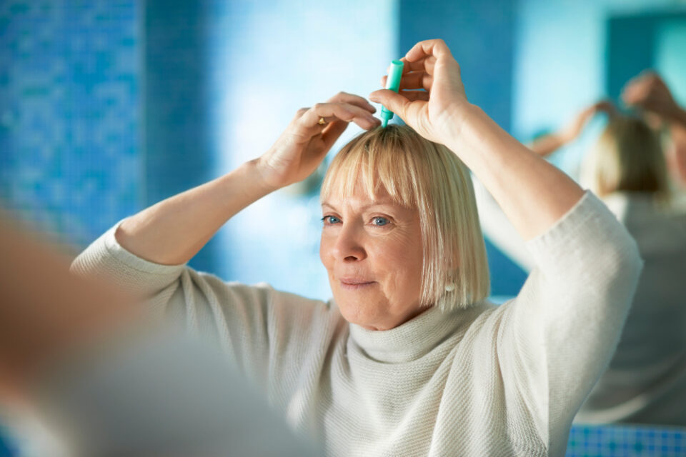 perte cheveux